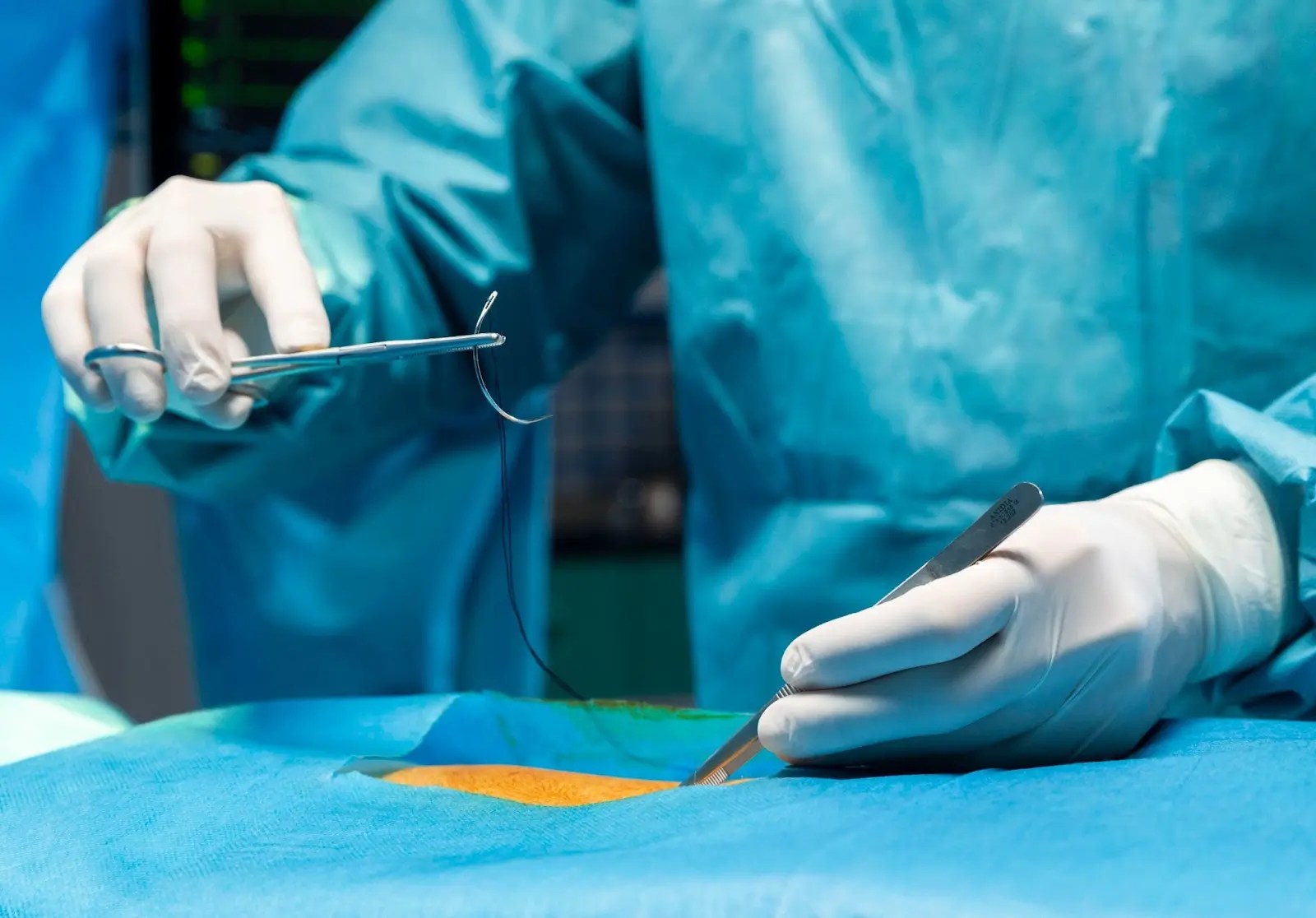 Penile Implant Surgery Cost